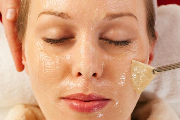 peeling quimico en mujeres