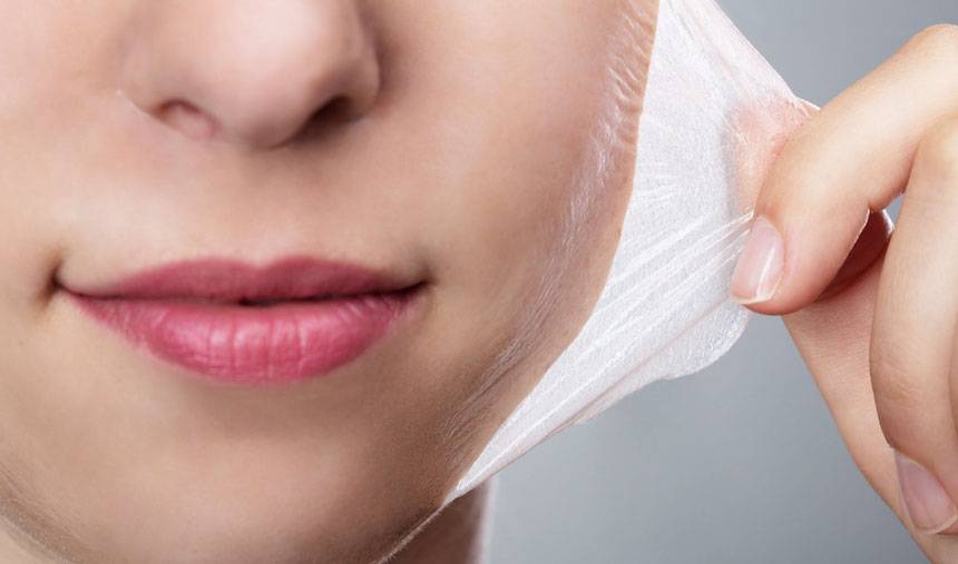 cuidados para un peeling quimico
